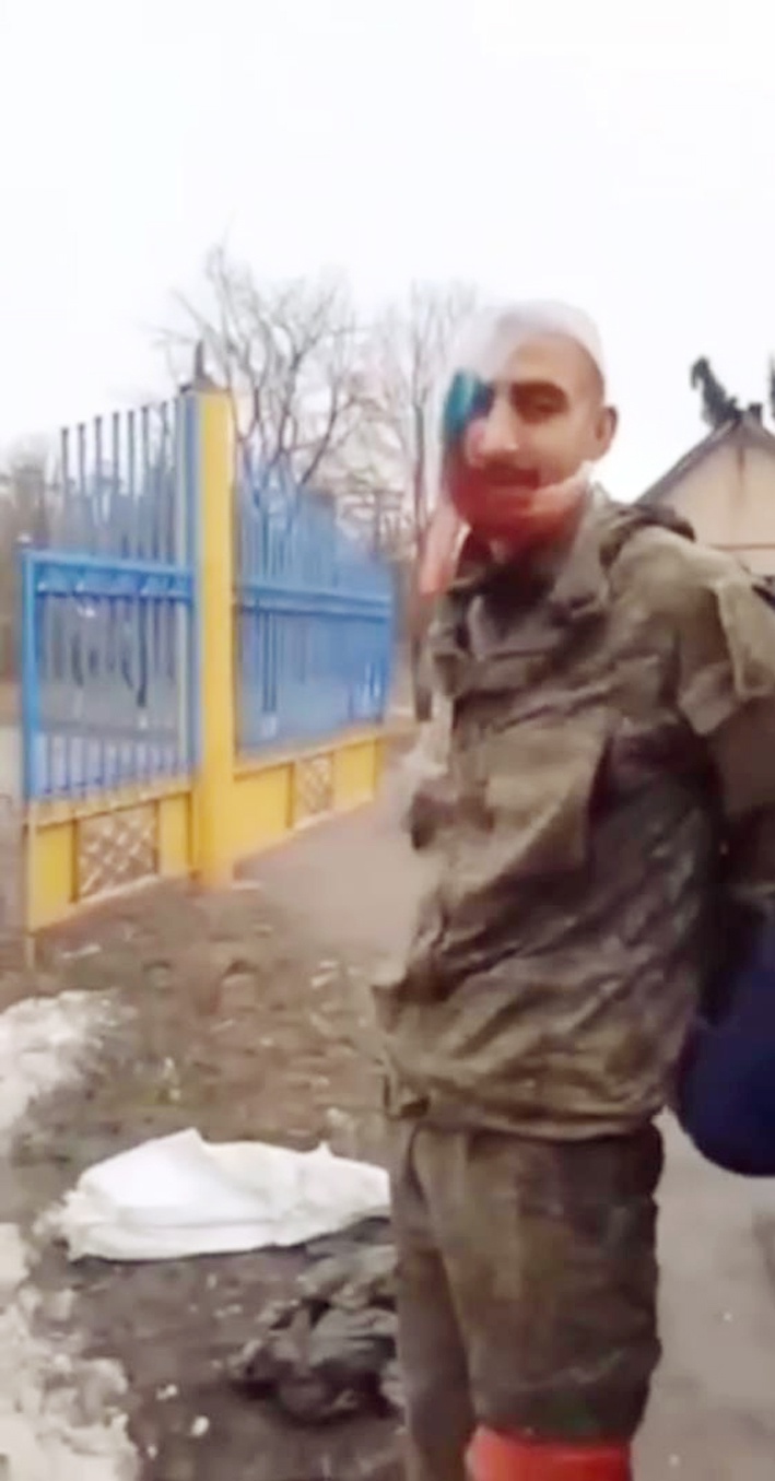 Пленный раненый российский солдат отказался кричать «слава украине».