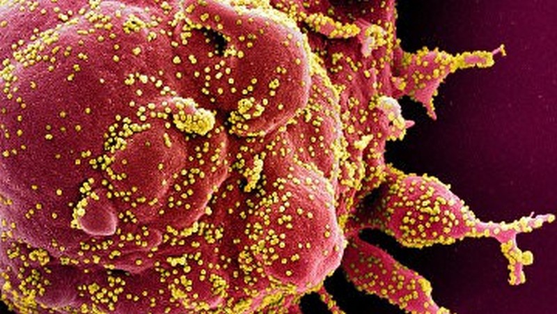 Ещё весной этого года британские и норвежские учёные заявили, что шип-белок коронавируса поразительно напоминает человеческий и выглядит так, будто его поместили в структуру вируса искусственно.