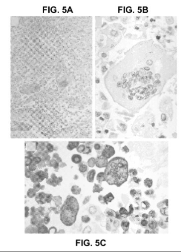 Скрин фото из патента US7776521B1, описывающего возбудителя тяжёлого острого респираторного синдрома (SARS) и недавно выделенного коронавируса человека (SARS-CoV).
