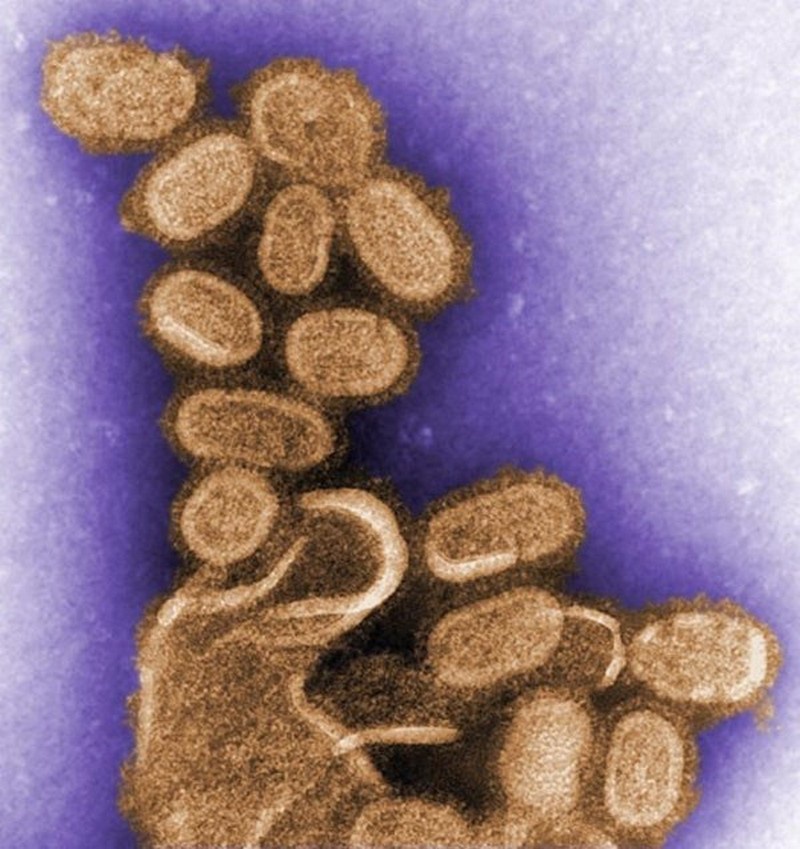 Цветное изображение вируса 1918 года, полученное с помощью просвечивающего электронного микроскопа (ТЕМ). 