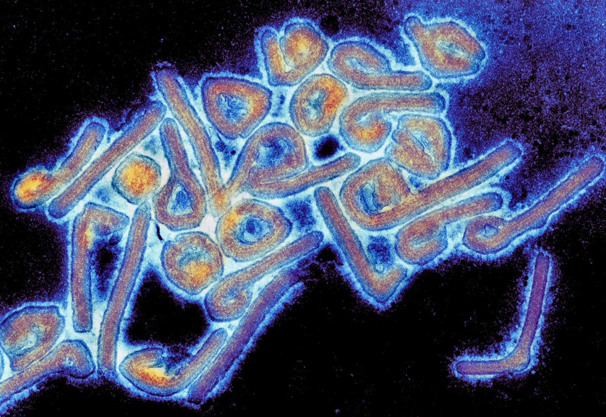 С огромной долей вероятности вирус Марбург целенаправленно был создан как биооружие.