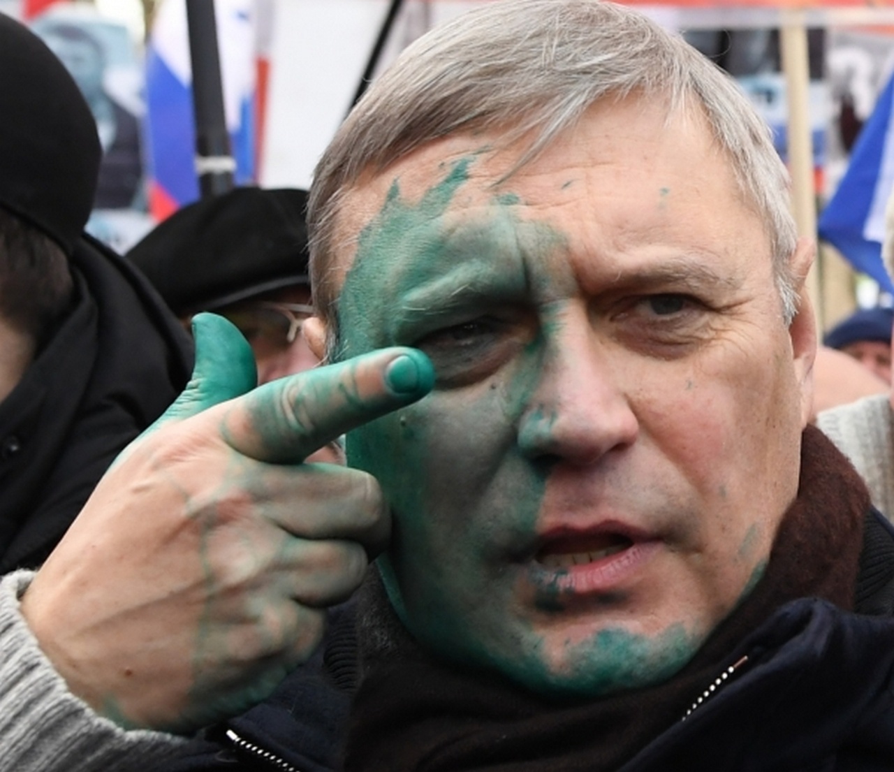 Председатель Партии народной свободы (ПАРНАС) (упразднена 25 мая 2023 года решением Верховного суда России) Михаил Касьянов получил свою порцию зелёнки.