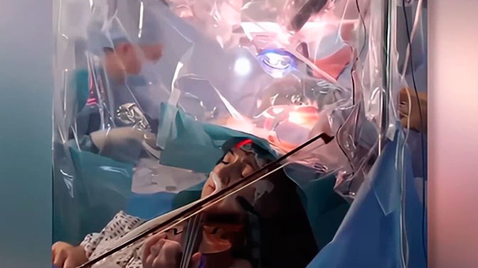 Музыкальный контроль: пациентка очнулась во время операции на мозге и начала играть на скрипке