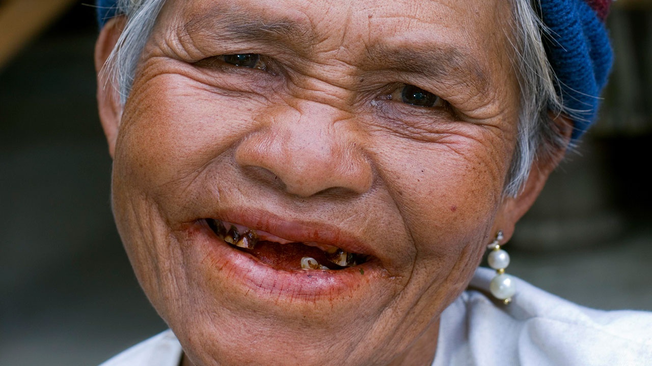 Ученые нашли способ вырастить выпавшие зубы