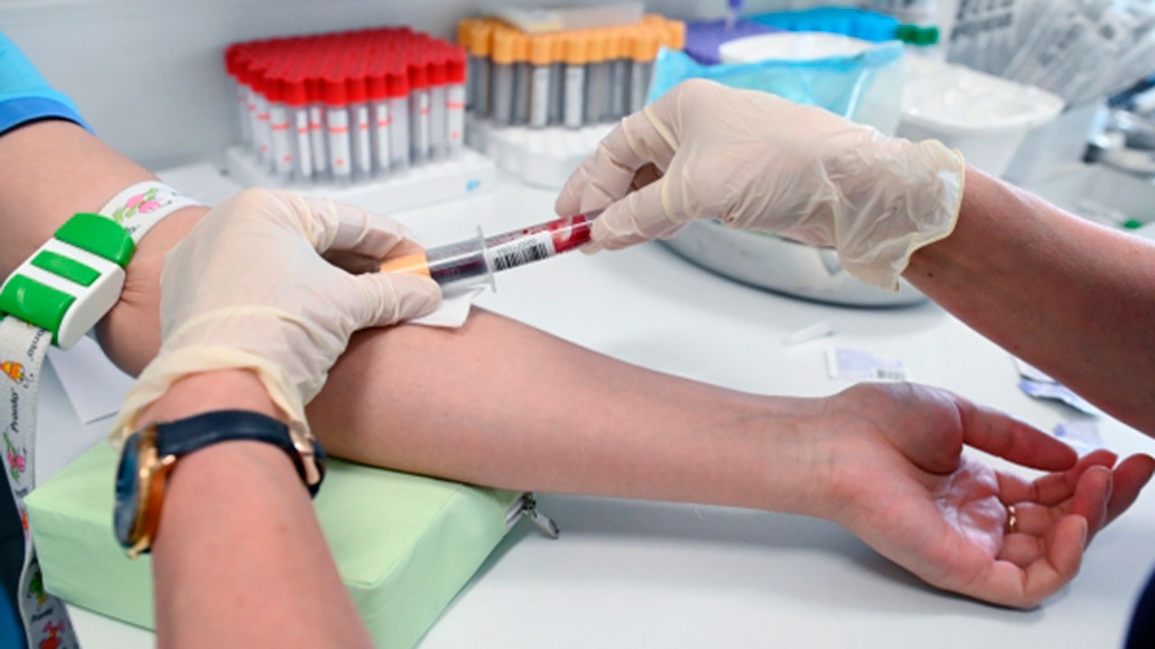 Эксперты рассказали, как избежать ошибок при сдаче тестов на антитела