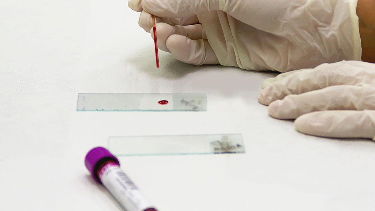 СМИ: КНР изучит образцы крови из Уханя для исследования природы COVID-19