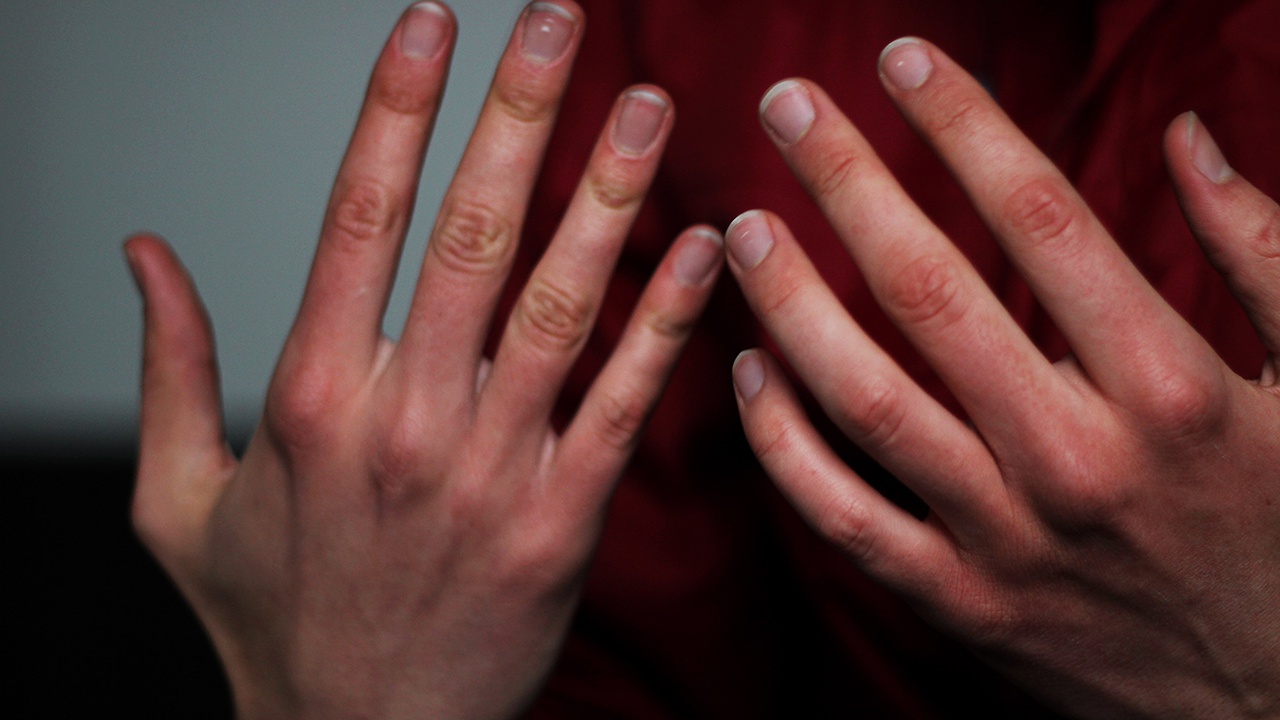 Холодные руки оказались признаком серьезных заболеваний