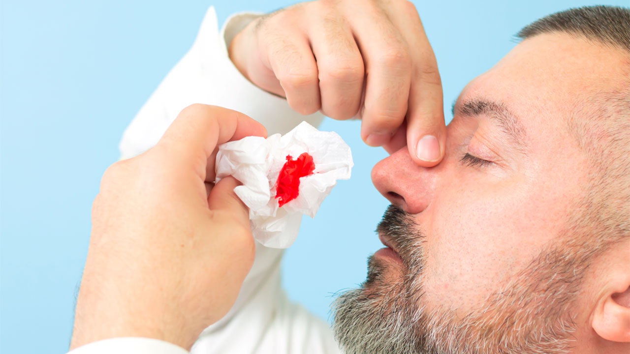 Гематолог назвала причины зимних кровотечений из носа