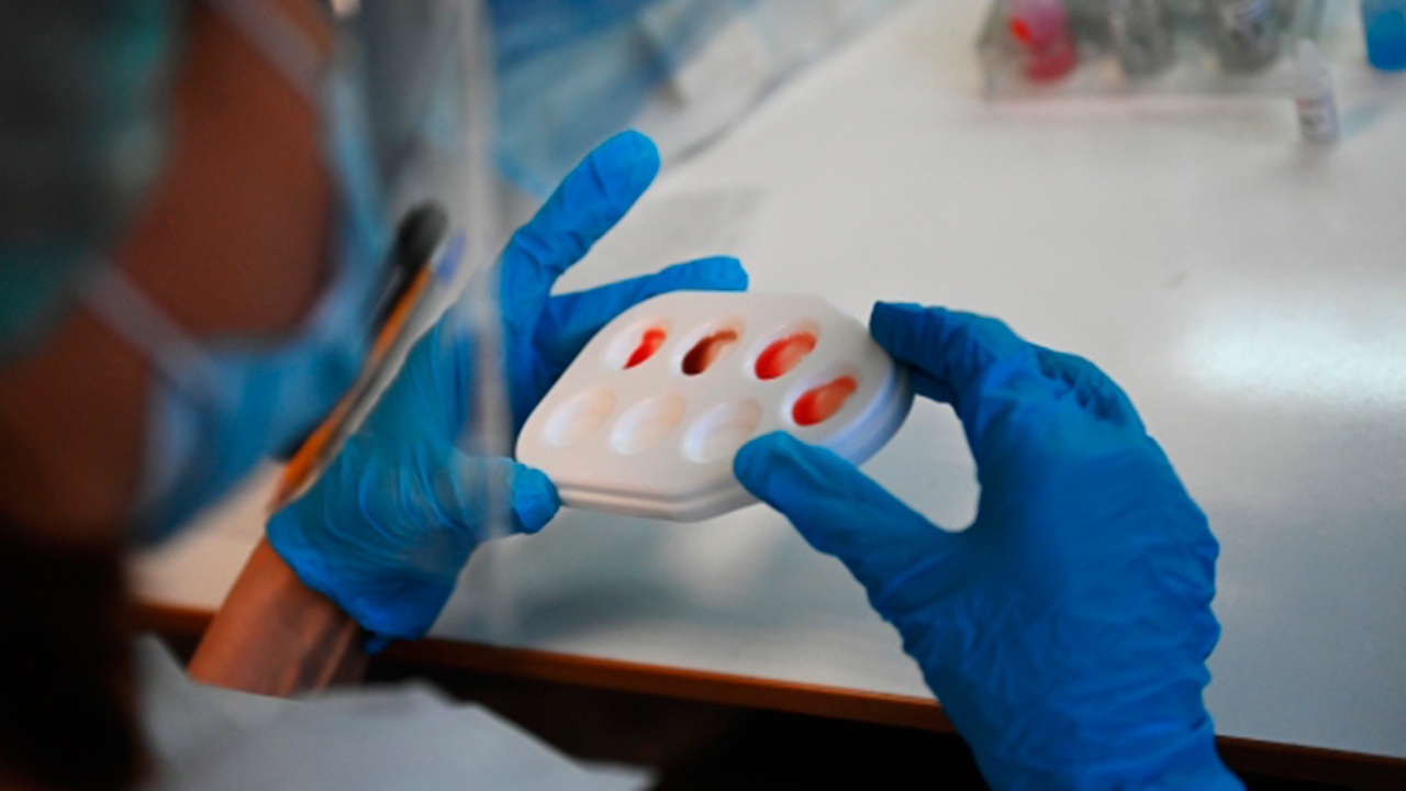 В Минздраве озвучили срок действия сертификата на основе теста на антитела к коронавирусу
